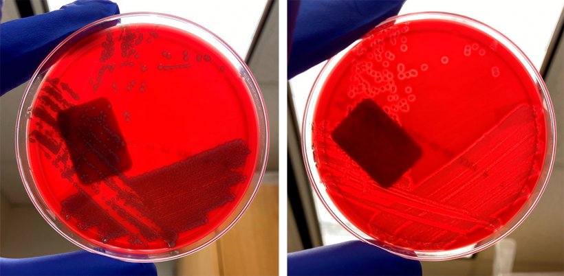 Non hemolytic E coli (left) and hemolytic E coli (right).